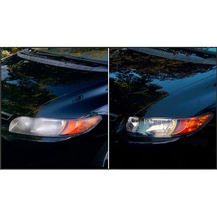 Philips HRK00XM - Komplet za obnovu farova